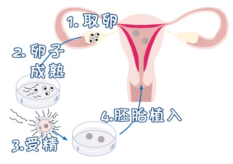 案例
