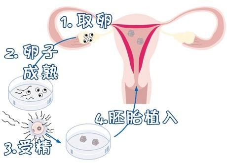 液氮存储